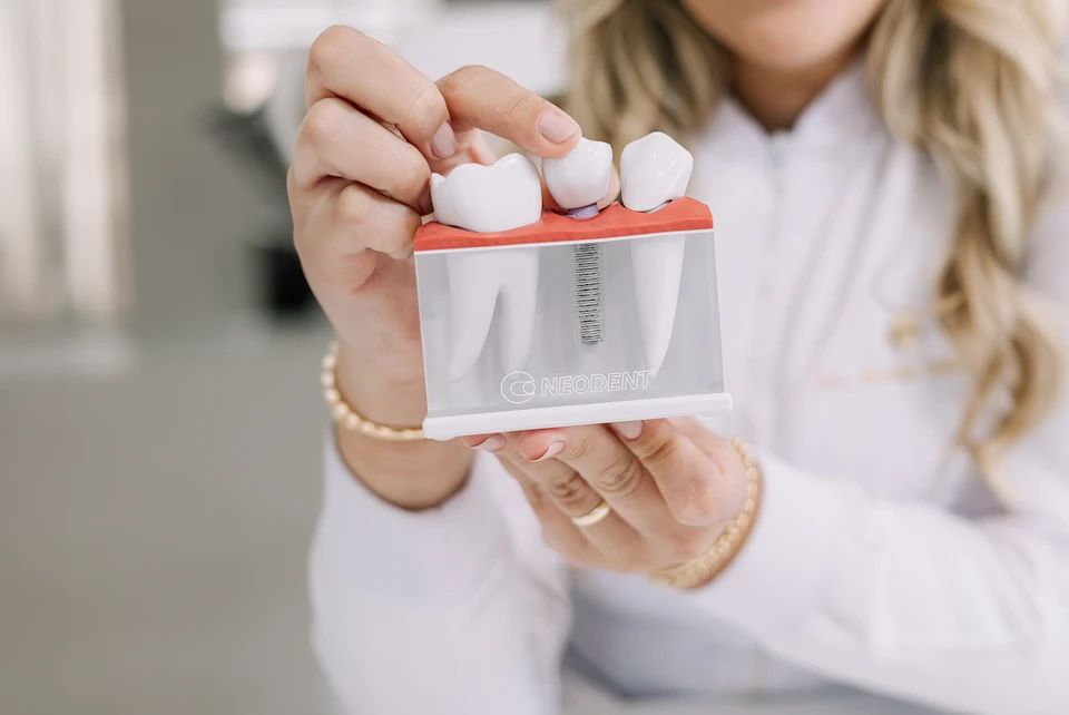 Instalação de implantes dentários