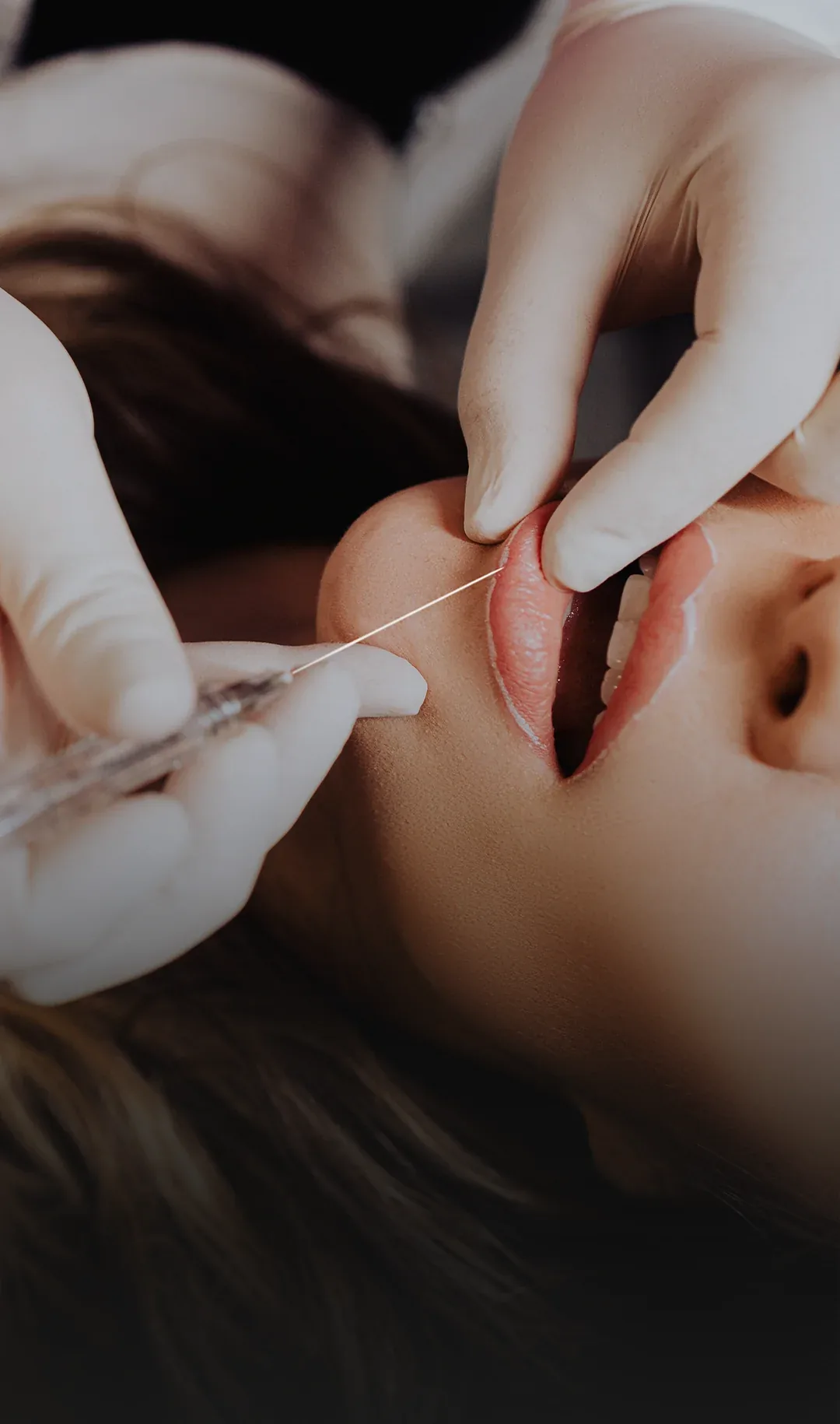 Mulher recebendo uma aplicação de preenchimento labial