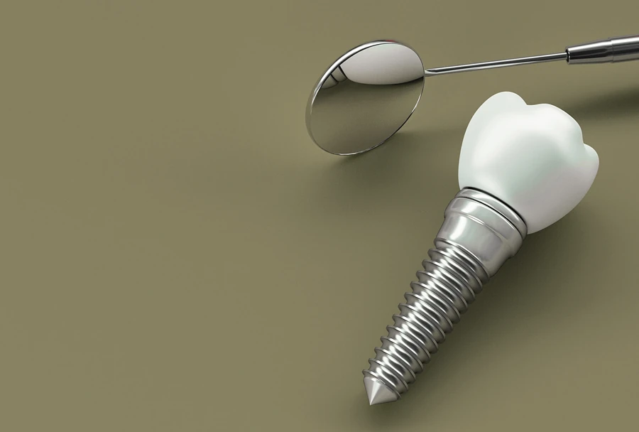 Implante Dentário