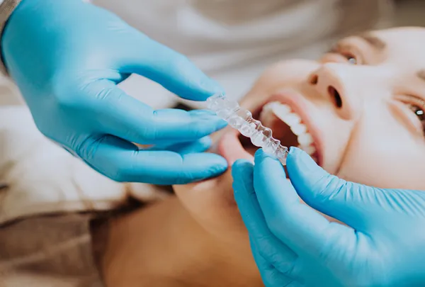 Alinhadores Invisíveis